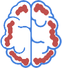 Alzheimer's Disease Brain Icon